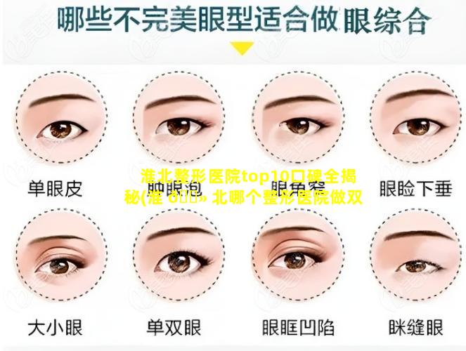 淮北整形医院top10口碑全揭秘(淮 🌻 北哪个整形医院做双眼皮好)